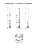 IN SITU HEAT TREATMENT OF A TAR SANDS FORMATION AFTER DRIVE PROCESS TREATMENT diagram and image