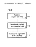 DEVICE AND METHOD FOR PROCESSING AND PRESENTATION OF X-RAY IMAGES diagram and image