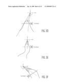 System and Method For The Analysis of Basic Ear Canal Taxonomy diagram and image