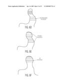 System and Method For The Analysis of Basic Ear Canal Taxonomy diagram and image