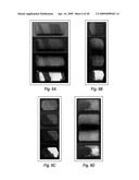 MICROSPHERE-BASED MATERIALS WITH PREDEFINED 3D SPATIAL AND TEMPORAL CONTROL OF BIOMATERIALS, POROSITY AND/OR BIOACTIVE SIGNALS diagram and image