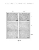 MICROSPHERE-BASED MATERIALS WITH PREDEFINED 3D SPATIAL AND TEMPORAL CONTROL OF BIOMATERIALS, POROSITY AND/OR BIOACTIVE SIGNALS diagram and image