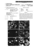 UPREGULATION OF RACK-1 IN MELANOMA AND ITS USE AS A MARKER diagram and image