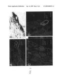 UPREGULATION OF RACK-1 IN MELANOMA AND ITS USE AS A MARKER diagram and image