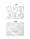 MARKER MOLECULES ASSOCIATED WITH LUNG TUMORS diagram and image