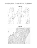 MARKER MOLECULES ASSOCIATED WITH LUNG TUMORS diagram and image