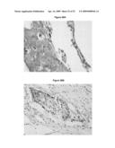 MARKER MOLECULES ASSOCIATED WITH LUNG TUMORS diagram and image