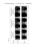 ASBESTOS DETECTION METHOD, ASBESTOS DETECTION AGENT, ASBESTOS DETECTION KIT, METHOD FOR SCREENING CANDIDATE FOR AGENT AIMING AT PREVENTING OR TREATING DISEASE FOR WHICH ASBESTOS IS CAUSATIVE OR WORSENING FACTOR diagram and image