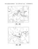 Protein Kinase Inhibitors diagram and image