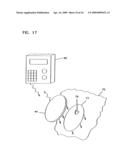 Analyte Monitoring Device and Methods of Use diagram and image