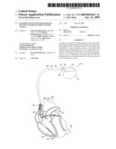 METHOD AND SYSTEM FOR TRACKING QUALITY OF LIFE IN PATIENTS WITH ANGINA diagram and image