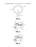 IMPLANTABLE CATHETER PORT diagram and image