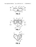 IMPLANTABLE CATHETER PORT diagram and image