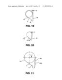 IMPLANTABLE CATHETER PORT diagram and image