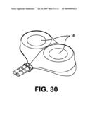 IMPLANTABLE CATHETER PORT diagram and image