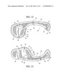 Orthotic device and method for securing the same diagram and image