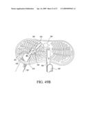 Orthotic device and method for securing the same diagram and image