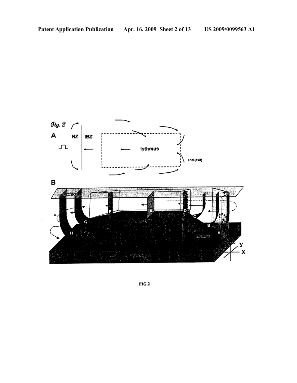 SYSTEMS AND METHODS FOR IMPLEMENTING HEART GEOMETRICAL MEASUREMENTS - diagram, schematic, and image 03