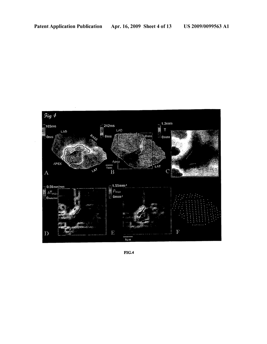 SYSTEMS AND METHODS FOR IMPLEMENTING HEART GEOMETRICAL MEASUREMENTS - diagram, schematic, and image 05