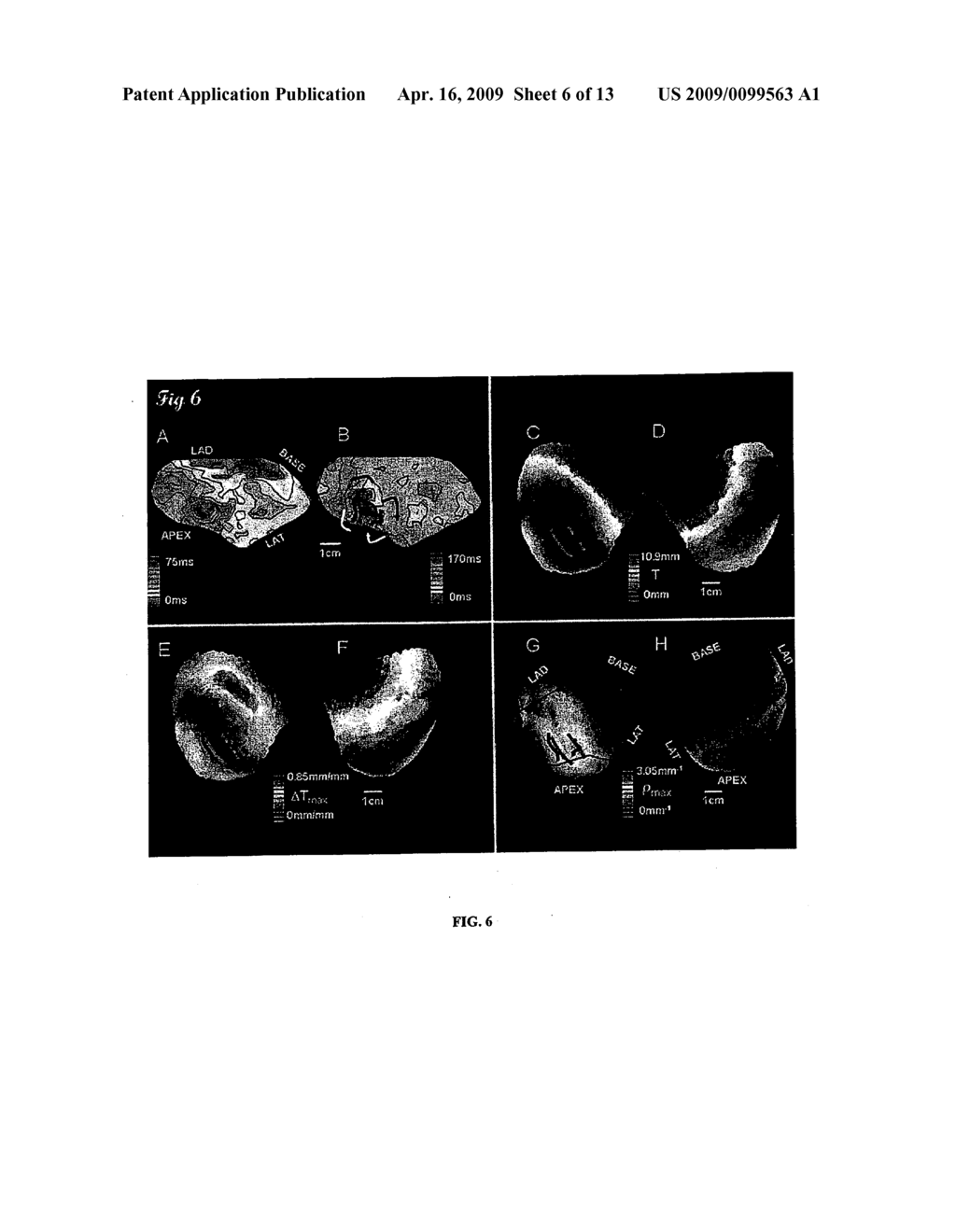 SYSTEMS AND METHODS FOR IMPLEMENTING HEART GEOMETRICAL MEASUREMENTS - diagram, schematic, and image 07