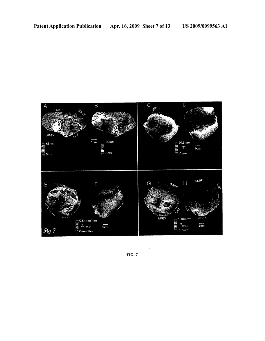 SYSTEMS AND METHODS FOR IMPLEMENTING HEART GEOMETRICAL MEASUREMENTS - diagram, schematic, and image 08