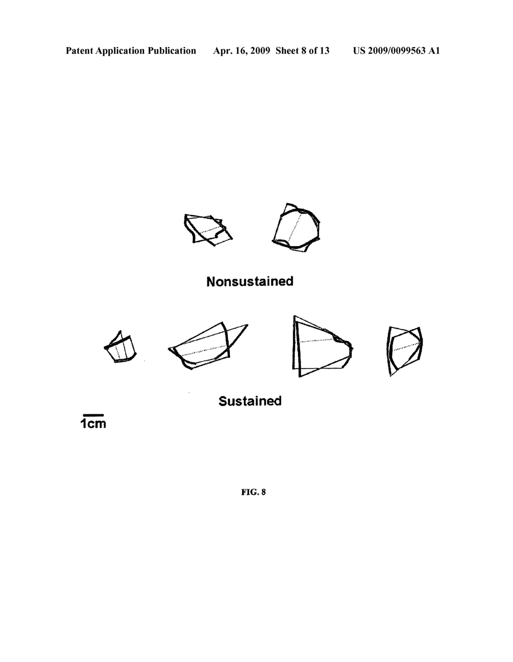 SYSTEMS AND METHODS FOR IMPLEMENTING HEART GEOMETRICAL MEASUREMENTS - diagram, schematic, and image 09