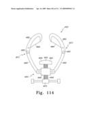 Customized Patient-Specific Bone Cutting Blocks diagram and image