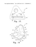 Customized Patient-Specific Bone Cutting Blocks diagram and image