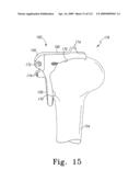 Customized Patient-Specific Bone Cutting Blocks diagram and image