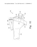 Customized Patient-Specific Bone Cutting Blocks diagram and image