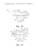 Customized Patient-Specific Bone Cutting Blocks diagram and image