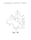 Customized Patient-Specific Bone Cutting Blocks diagram and image