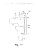 Customized Patient-Specific Bone Cutting Blocks diagram and image