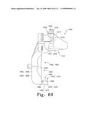 Customized Patient-Specific Bone Cutting Blocks diagram and image