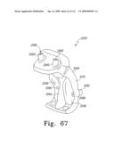 Customized Patient-Specific Bone Cutting Blocks diagram and image