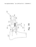 Customized Patient-Specific Bone Cutting Blocks diagram and image