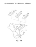 Customized Patient-Specific Bone Cutting Blocks diagram and image