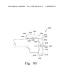 Customized Patient-Specific Bone Cutting Blocks diagram and image