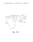 Customized Patient-Specific Bone Cutting Blocks diagram and image