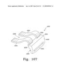 Customized Patient-Specific Bone Cutting Blocks diagram and image