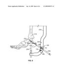 VARIABLE ANGLE TARGETING DEVICE diagram and image