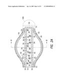 Lacrimal implant detection diagram and image