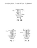 Lacrimal implant detection diagram and image