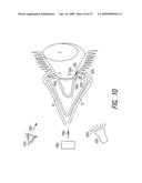 Lacrimal implant detection diagram and image