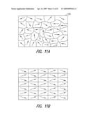 Lacrimal implant detection diagram and image