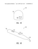 Lacrimal implant detection diagram and image