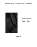 MUSCLE LAMIN A/C INTERACTING PROTEIN, GENE ENCODING SAME, AND USES THEREFOR diagram and image