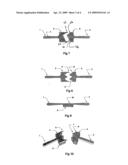 Two part hairline parting device diagram and image