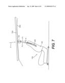 OCCUPANT SAFETY DEVICE FOR ROOF REINFORCEMENT diagram and image