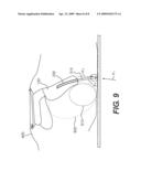 OCCUPANT SAFETY DEVICE FOR ROOF REINFORCEMENT diagram and image